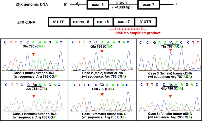 Expression of mutation-bearing ZFX alleles in parathyroid adenomas