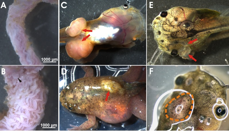 Neoplastic phenotypes observed in apc TALEN mRNA injected tadpoles and frogs