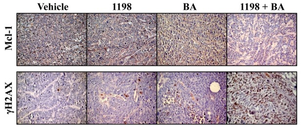 1198 + BA decreases Mcl-1 and increases DNA damage-associated γH2AX in TRAMP PCa
