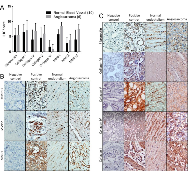 Expression of extracellular matrix components and their regulators in angiosarcoma and non-diseased endothelial tissues