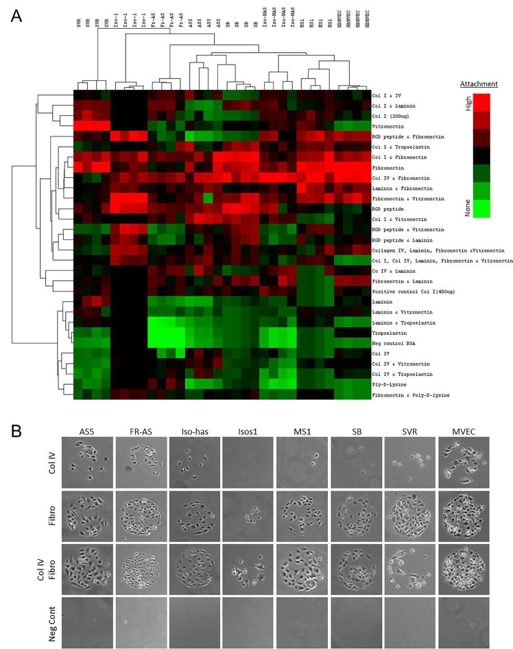 Extracellular matrix attachment preference of angiosarcoma cells