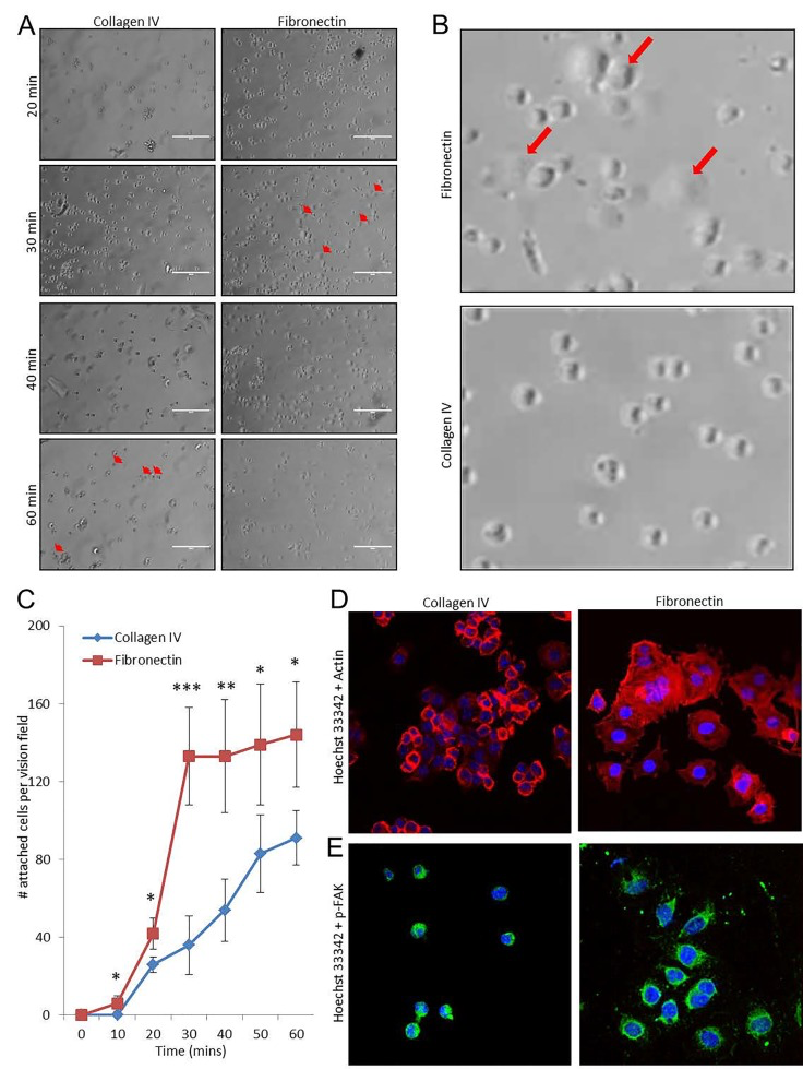 Timing of angiosarcoma cell adhesion to extracellular matrix substrates