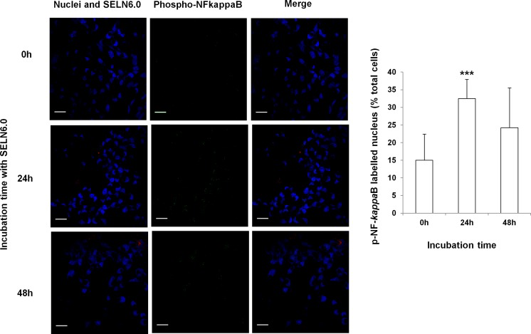 Effects of SELN6.0 on the phosphorylated NF-kB nuclear translocation